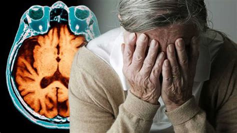 New alzheimer - Nov 30, 2022 · The first drug to slow the destruction of the brain in Alzheimer's has been heralded as momentous. The research breakthrough ends decades of failure and shows a new era of drugs to treat Alzheimer ... 